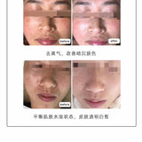 👧🏻日本KS透白肌碳酸美白護理面膜30分鐘 肌膚【透白】✔️✔️✔️